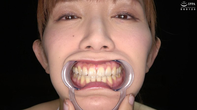 【歯・口内フェチ】綺麗なお姉さんの激レアな治療跡がある歯・口内・のどちんこ観察! 美泉咲