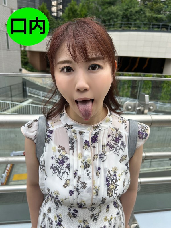 街角口内11