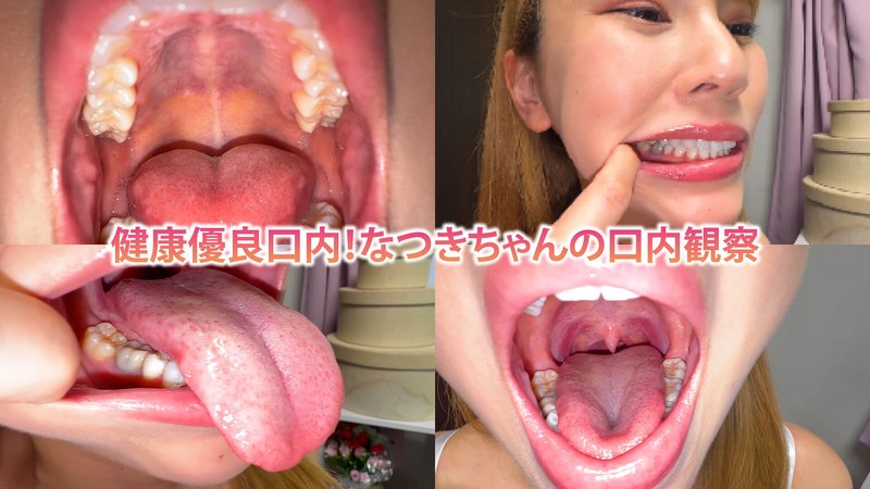 「健康優良口内！なつきちゃんの日内観察」【h_1651nko0800002】