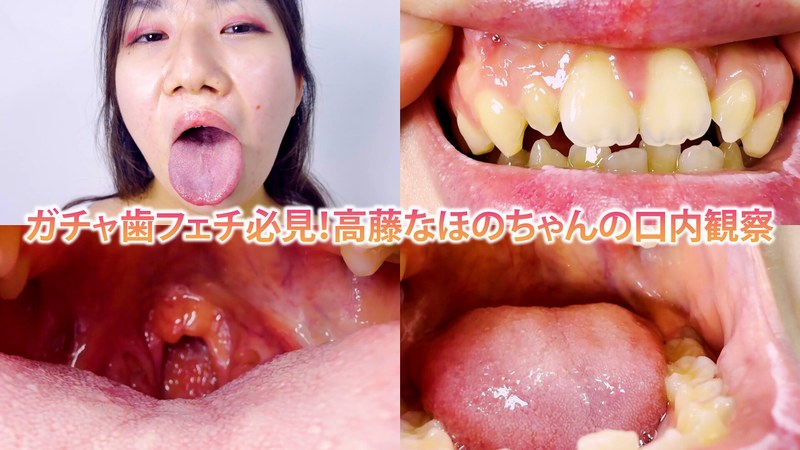 高藤なほの「ガチャ歯フェチ必見！高藤なほのちゃんの口内観察」【h_1651nko0800003】